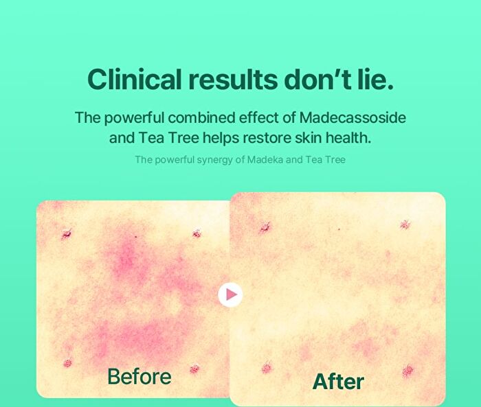 Hiffect Madeca Tea Tree Ampoule - 50ml