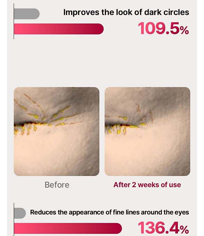 Eye Rejuv - 1 Set