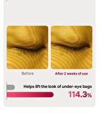 Eye Rejuv - 1 Set