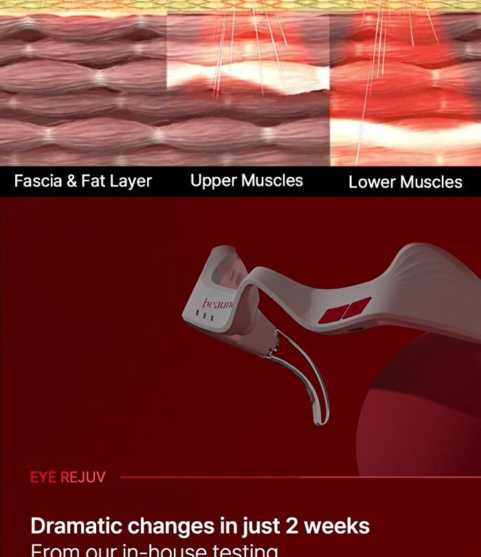 Eye Rejuv - 1 Set