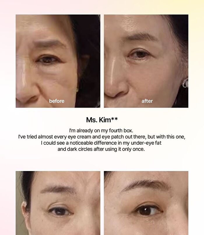 PDRN-C Wrinkle Repair Eye Patch - 60 patches