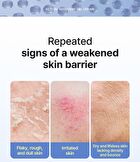 Skin&lab Ectoin Recovery Gel Cream - 55ml