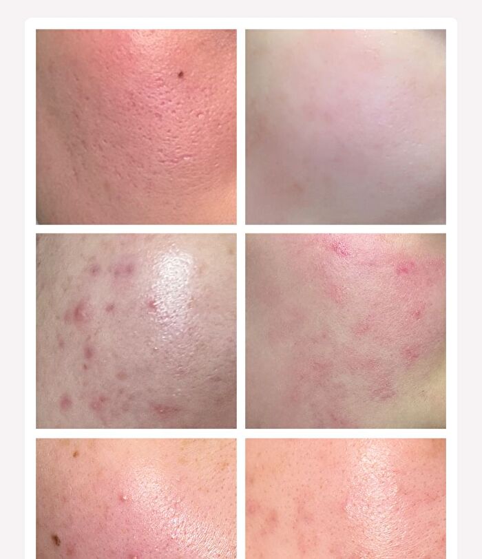 Apple Lacto Calming Serum - 30ml