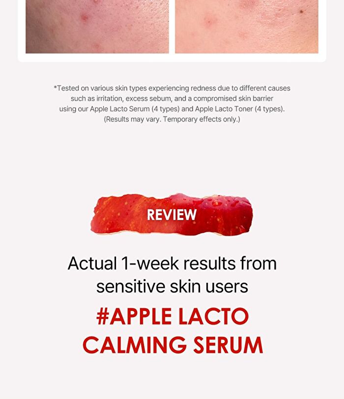 Apple Lacto Calming Serum - 30ml