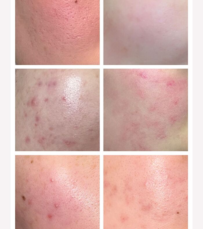 Apple Lacto Calming Popping Toner - 95g