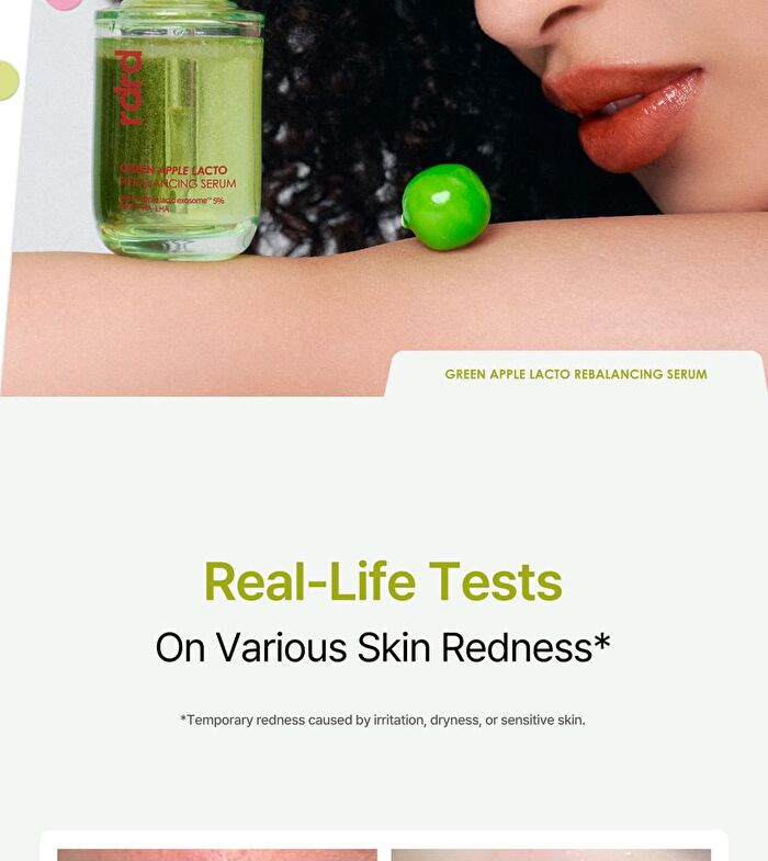 Green Apple Lacto Rebalancing Serum - 30ml