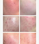 Green Apple Lacto Rebalancing Serum - 30ml