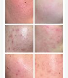 Green Apple Lacto Rebalancing Popping Toner - 95g