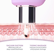 Foreo Kiwi Derma Mikrodermabrazivní Přístroj Pro čištění A Obnovu Pleti